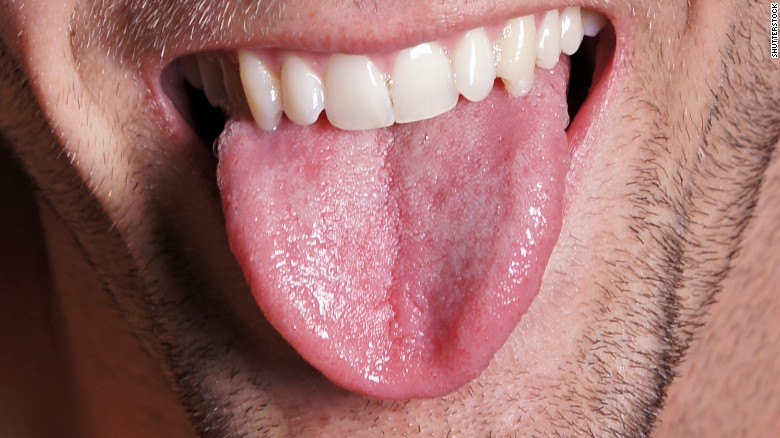 Things You Didn’t Know Your Tongue Can Do – Kabc-am